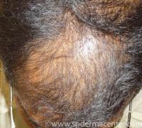 Hair Before